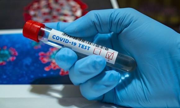 Станом на 1 грудня на Вінниччині 983 людини хворіють на коронавірус