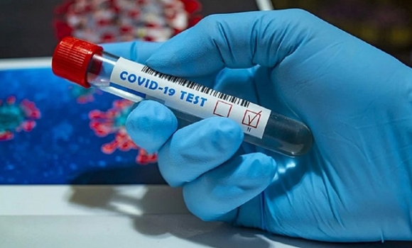 Станом на 21 жовтня на Вінниччині 2 670 людей хворіють на коронавірус