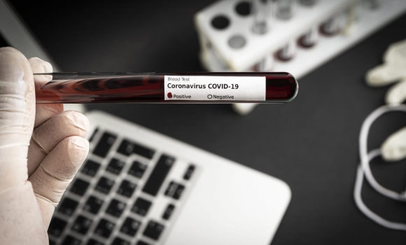 Станом на 8 грудня на Вінниччині 916 людей хворіють на коронавірус