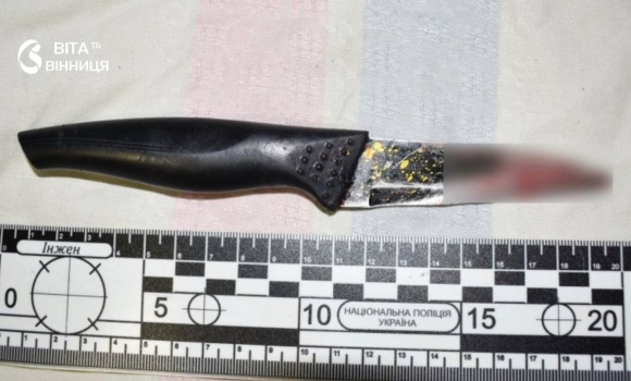 У Ладижині 56-річний чоловік під час застілля порізав ножем обличчя та шию знайомій