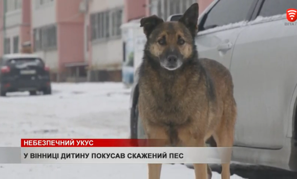 У Вінниці дитину покусав скажений пес