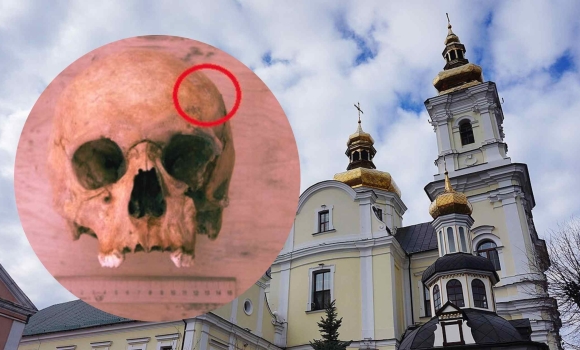 У Вінниці археологи зробили унікальну знахідку стародавній череп зі слідами трепанації У Вінниці археологи зробили унікальну знахідку стародавній череп зі слідами трепанації