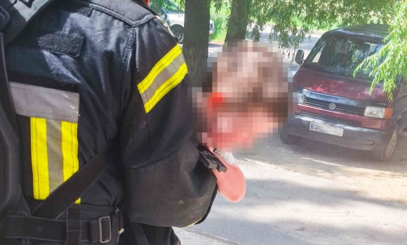 У Вінниці горіло в багатоповерхівці дворічна дитина потрапила у лікарню