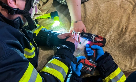 У Вінниці рятувальники розрізали обручку, щоб врятувати палець жінки