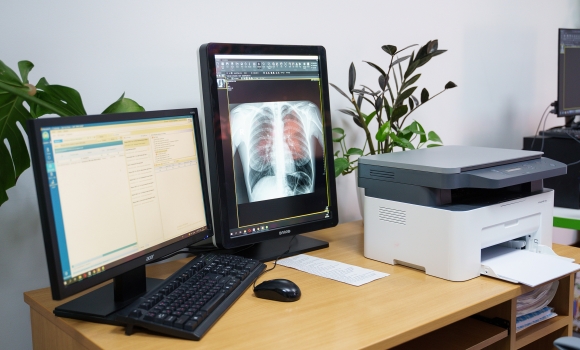 Вінницька лікарня швидкої допомоги отримала сучасний рентген-монітор