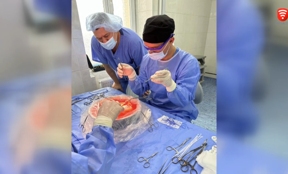 Вінницькі медики врятували ще одне життя: в лікарні ім Пирогова провели першу трансплантацію печінки