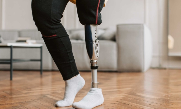 Вінницькі воїни з ампутованими кінцівками можуть отримати компенсацію за лікування