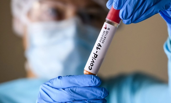 За добу, 29 грудня, на Вінниччині 32 людини захворіли на коронавірус