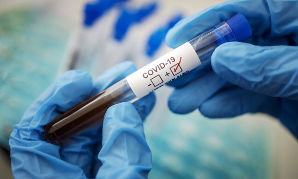 За добу, 29 листопада, на Вінниччині 31 людина захворіла на коронавірус