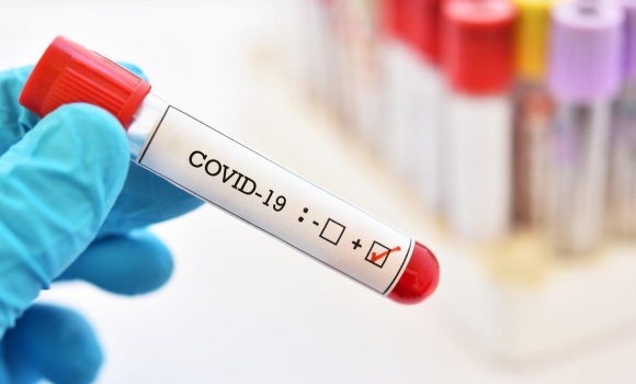 За добу, 5 грудня, на Вінниччині 32 людини захворіли на коронавірус