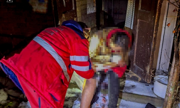 За добу на Вінниччині вибухнули два котли – травмувалася 36-річна жінка