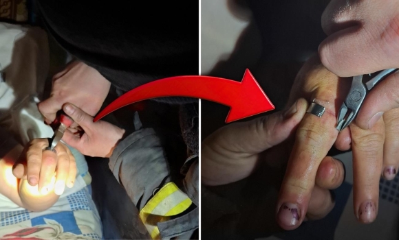 Замість каблучки — шайба вінницькі рятувальники визволяли жінку з металевого «полону»