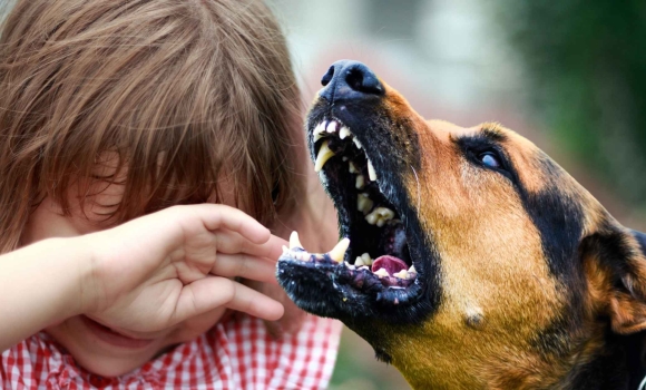 Зграя собак на Вінниччині ледь не роздерла 11-річну дівчинку Зграя собак на Вінниччині ледь не роздерла 11-річну дівчинку