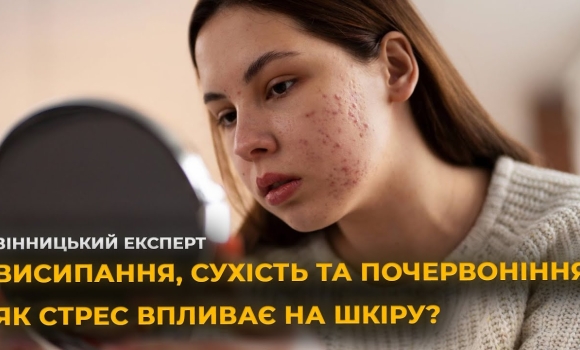 Embedded thumbnail for Як стрес впливає на нашу шкіру? Говоримо із дерматологом