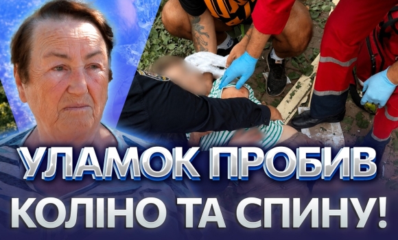 Embedded thumbnail for Жінка у реанімації після атаки на Вінницю: уламки дрона впали у дворах. Понад 20 будинків розтрощено