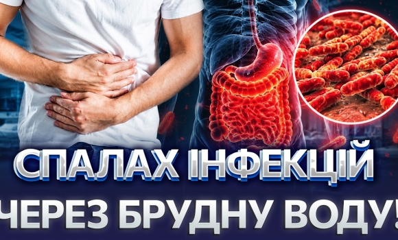 Embedded thumbnail for Епідемія у Вінниці?! У людей підозра на холеру, вже 17 хворих з кишковою інфекцією