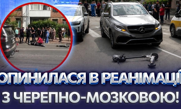 Embedded thumbnail for ДТП із самокатом у Вінниці: дівчина раптово вилетіла під колеса авто. У потерпілої важка травма