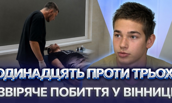 Embedded thumbnail for Розбили голову і відібрали гаманець: у жертви струс мозку і травма ока. Причина нападу шокувала всіх