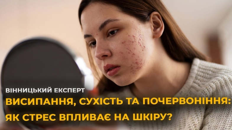 Embedded thumbnail for Як стрес впливає на нашу шкіру? Говоримо із дерматологом