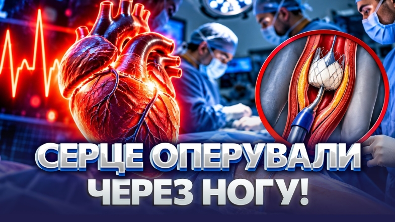 Embedded thumbnail for Замінили клапан без розрізу грудини: хірурги освоїли нову технологію. Як вчасно розпізнати інфаркт