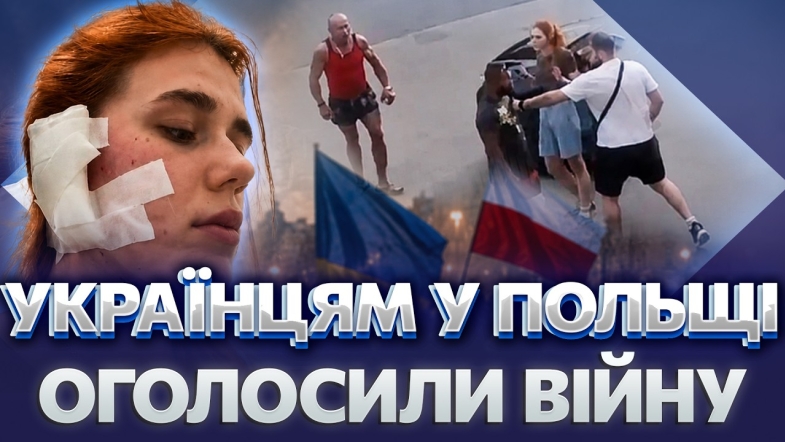 Embedded thumbnail for Скандальне побиття українців у Польщі: не сподобався український акцент. Градус ненависті зростає