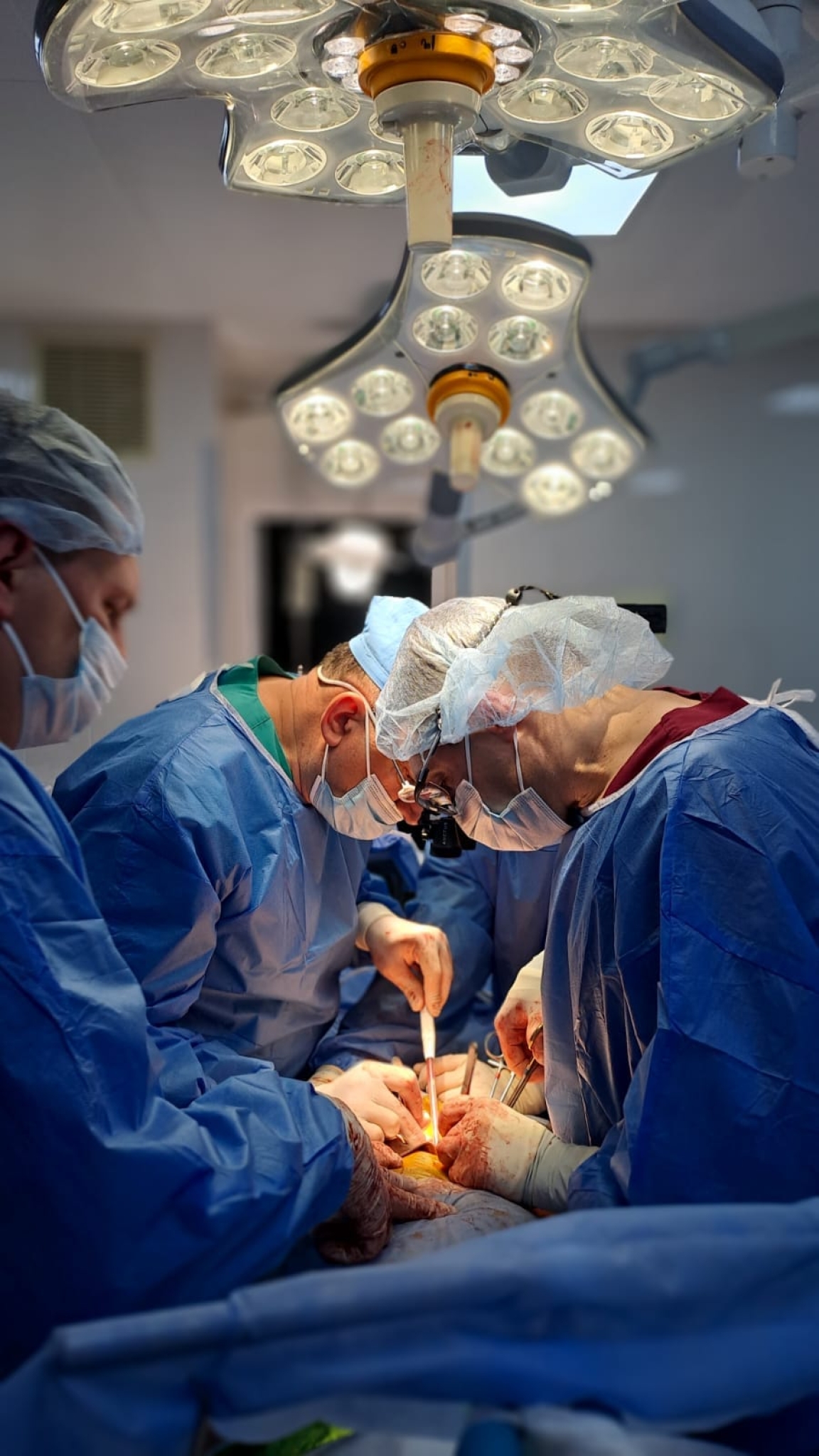 В лікарні ім. Пирогова у Вінниці провели ще дві трансплантації органів