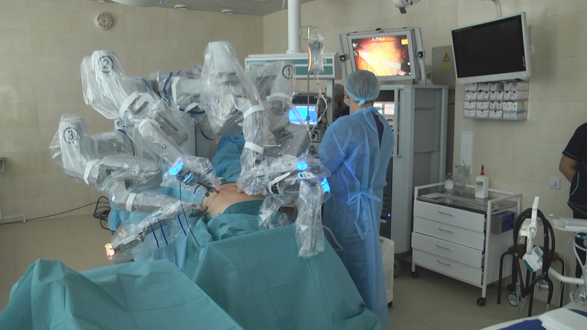 Операція в декілька "рук": як працює єдиний в Україні робот-хірург