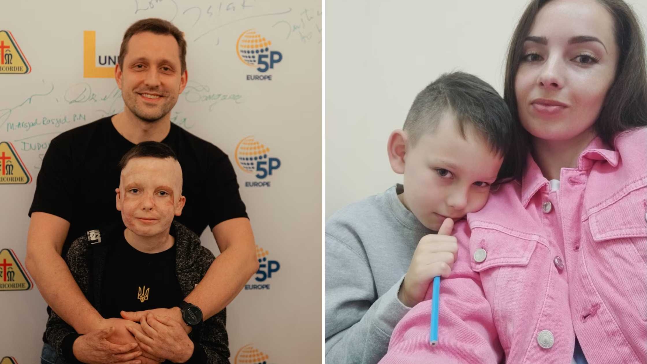 Історія Романа Олексіва, який вижив після ракетного удару по Вінниці