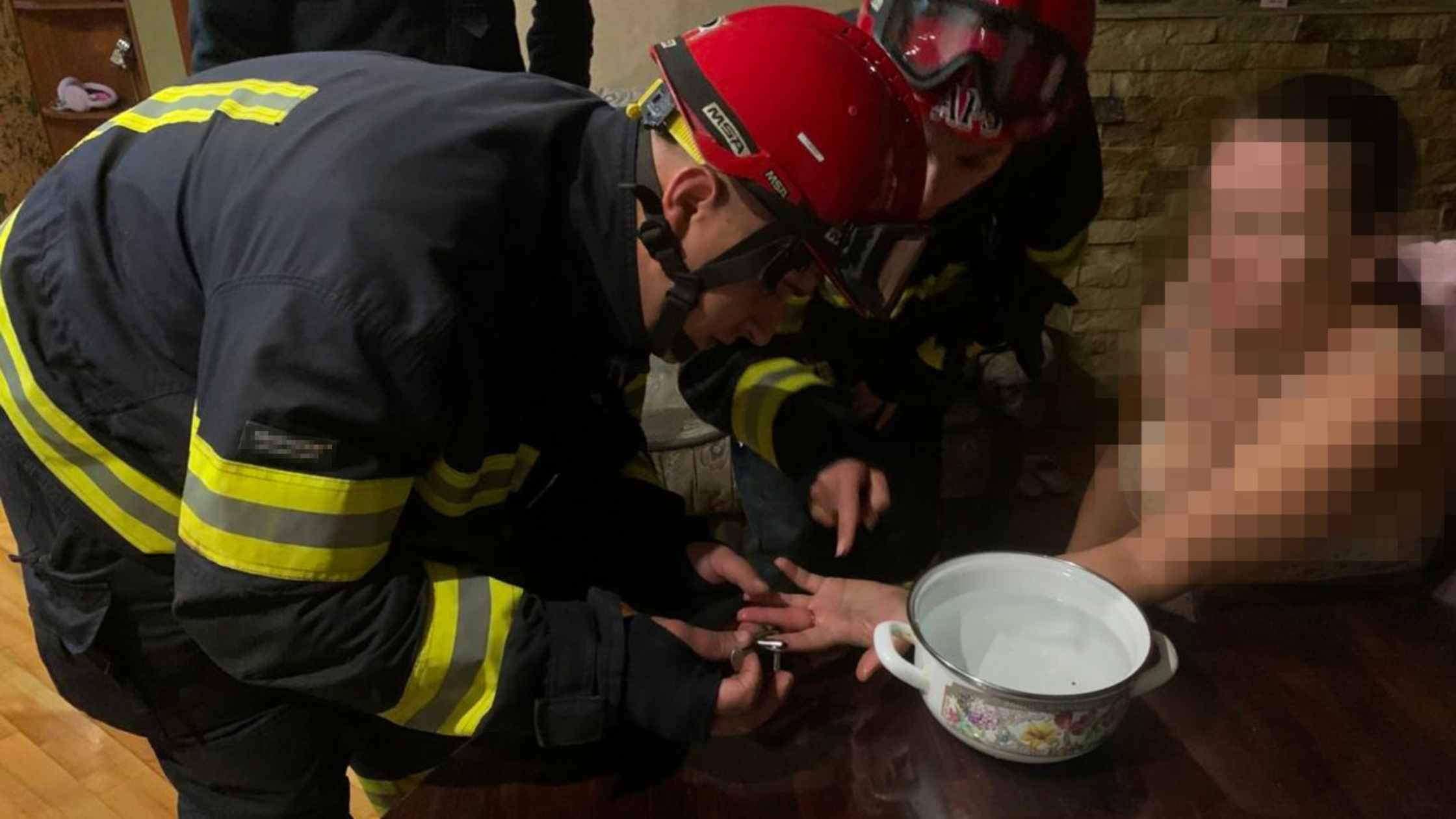 Щоб зняти обручку з пальця, вінничанці довелось викликати рятувальників