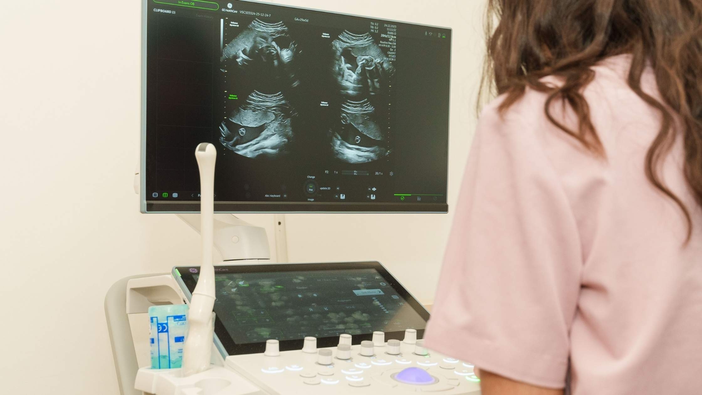 Вінниця отримала першу партію медобладнання, придбаного за допомоги Тайваню