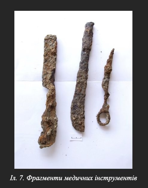 У Вінниці археологи зробили унікальну знахідку стародавній череп зі слідами трепанації