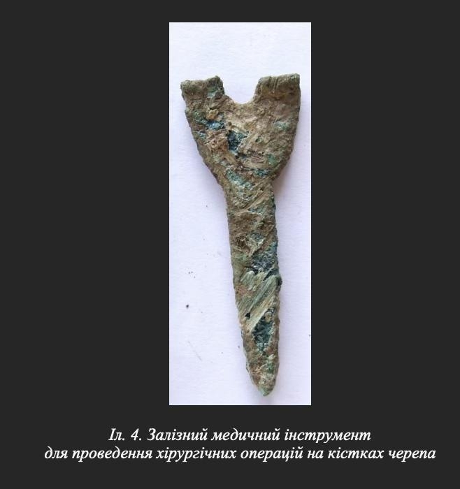 У Вінниці археологи зробили унікальну знахідку стародавній череп зі слідами трепанації