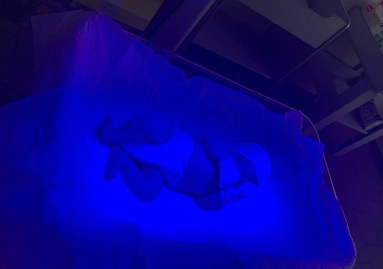 Пологове відділення у Калинівській лікарні тепер має лампу фототерапії