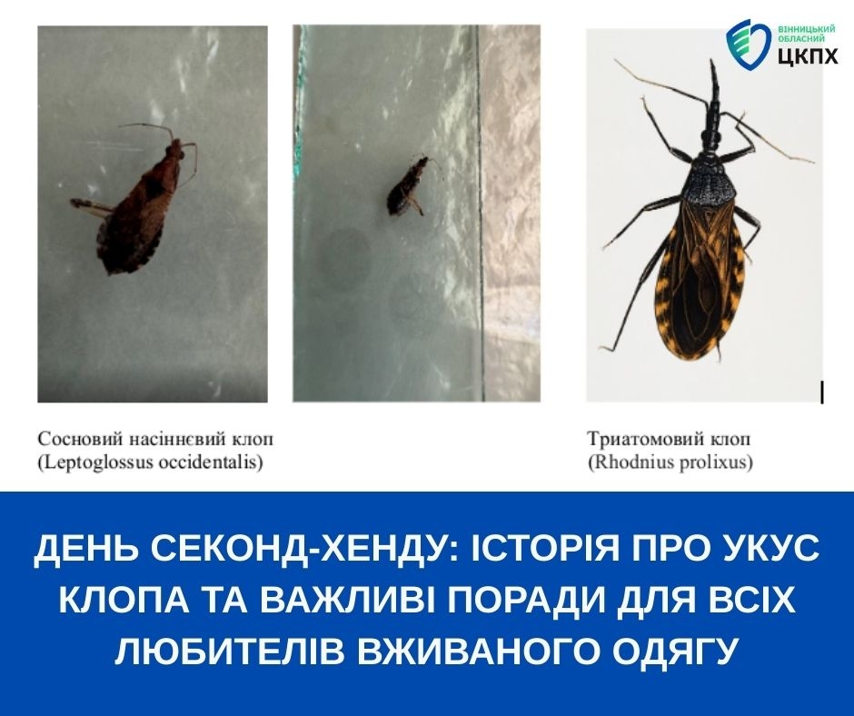 Вінничанку покусав клоп, коли вона приміряла штани в секонд-хенді