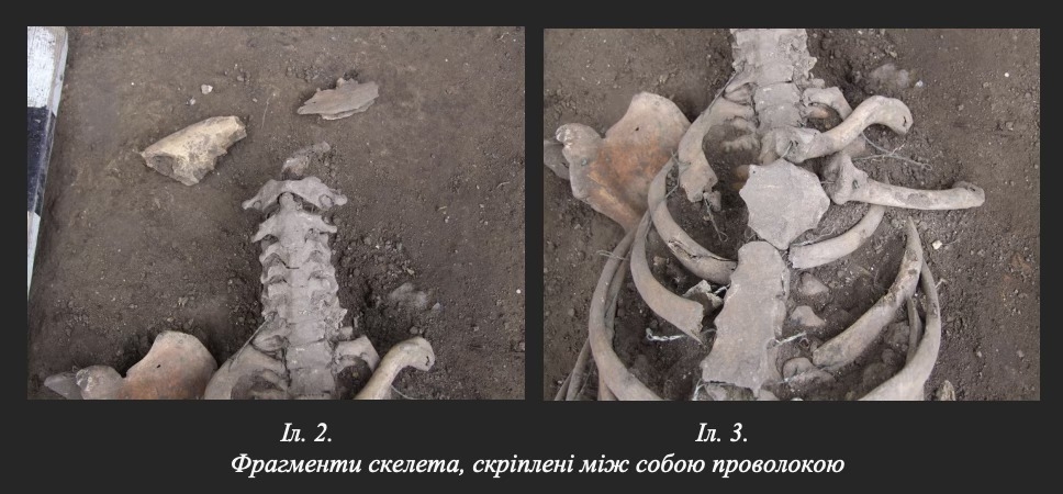 У Вінниці археологи зробили унікальну знахідку стародавній череп зі слідами трепанації