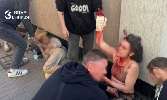 «Нова сторінка деградації окупантів» у державі та медіаспільноті відреагували на обстріл телеканалу «Нова сторінка деградації окупантів» у державі та медіаспільноті відреагували на обстріл телеканалу