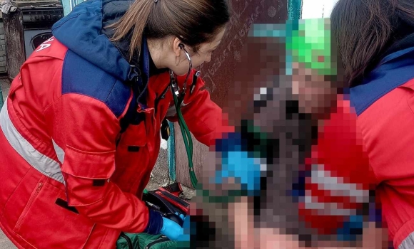 На Вінниччині жінка отримала опіки, коли випалювала суху траву На Вінниччині жінка отримала опіки, коли випалювала суху траву